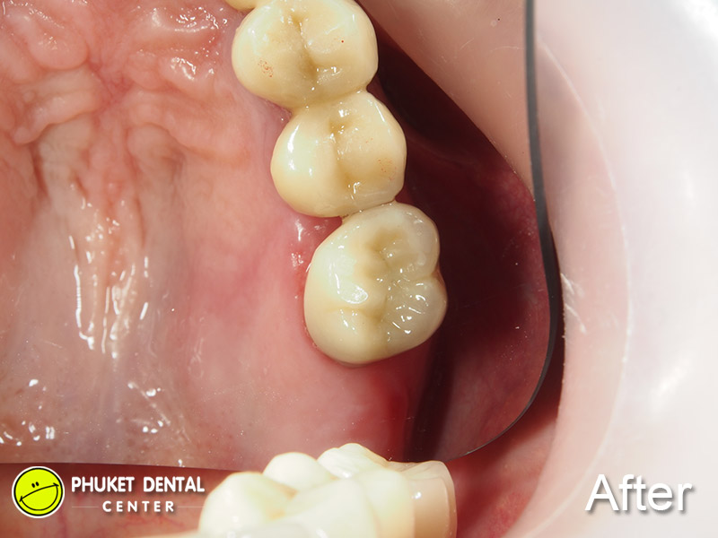 Phuket Dental Center